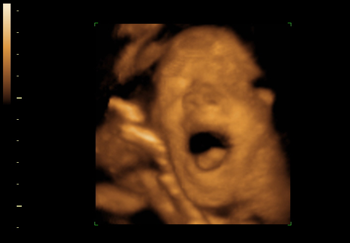3d sonogram image at 30 weeks