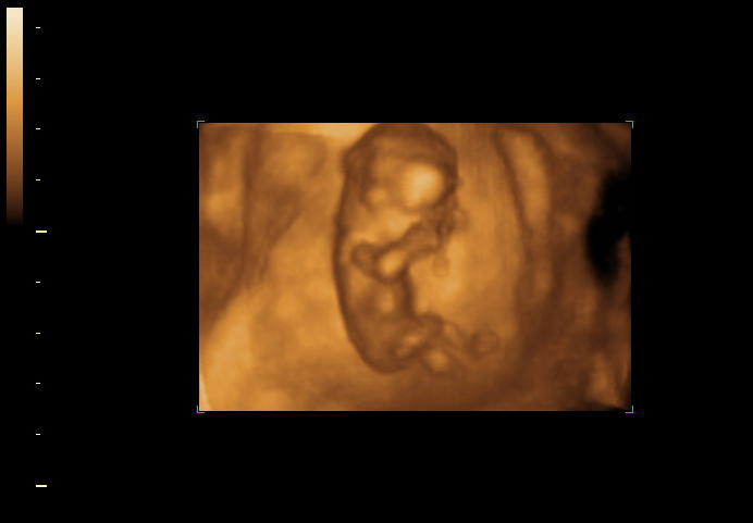 3d sonogram image at 12 weeks