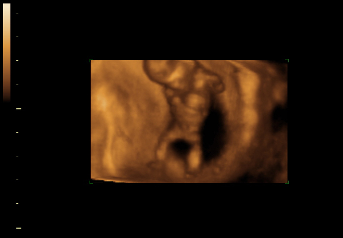 3d sonogram image at 12 weeks