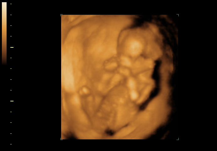 3d sonogram image at 16 weeks