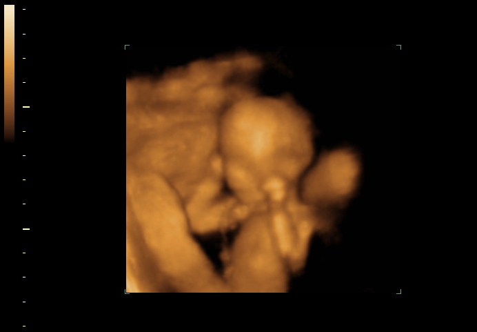 3d sonogram image at 16 weeks