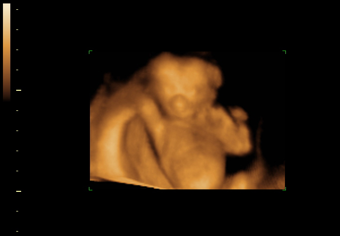 3d sonogram image at 16 weeks