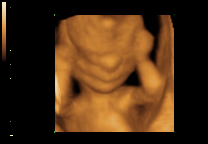 3d sonogram image at 16 weeks