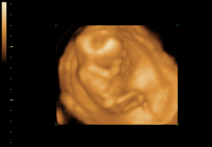 3d sonogram image at 16 weeks