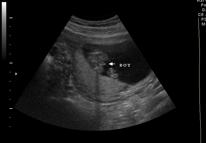 3d sonogram image at 16 weeks