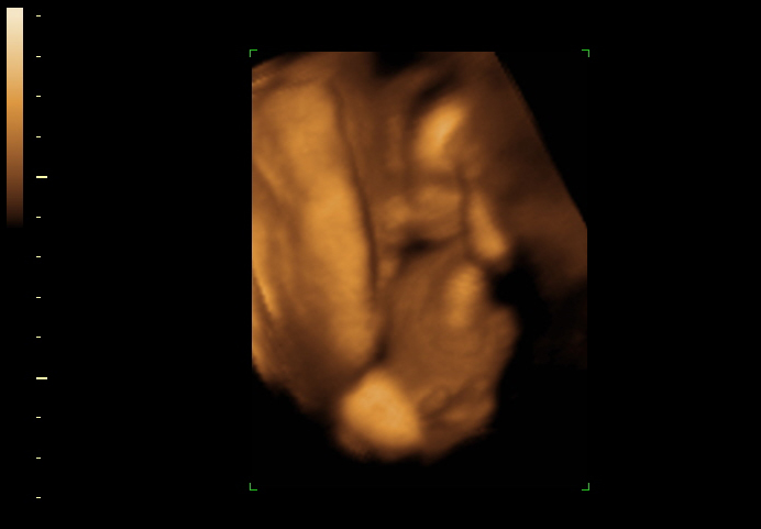 3d sonogram image at 16 weeks