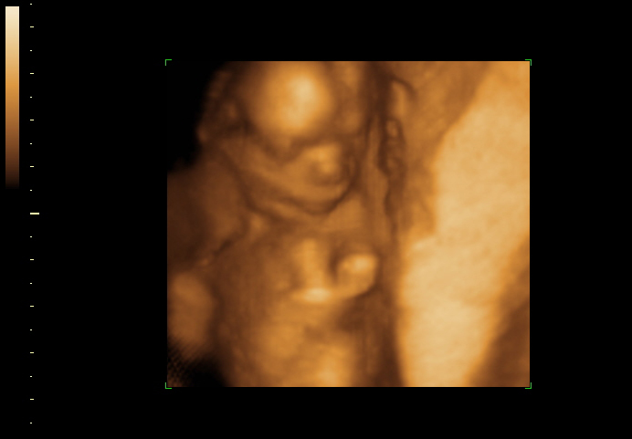 3d sonogram image at 16 weeks