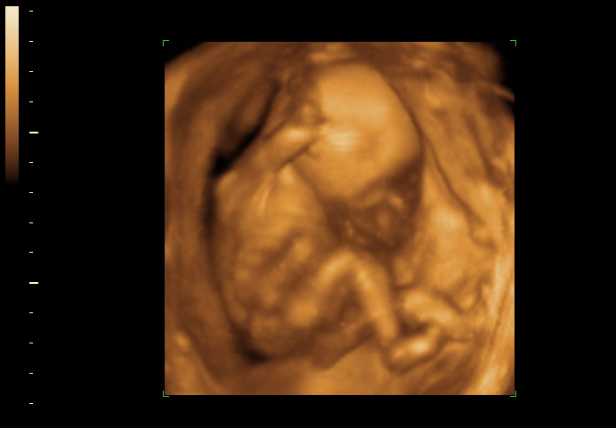3d sonogram image at 19 weeks