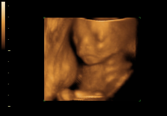 3d sonogram image at 19 weeks