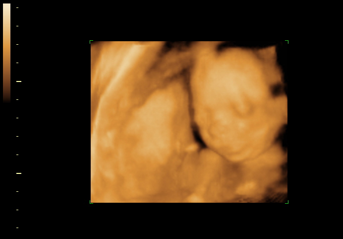 3d sonogram image at 21 weeks