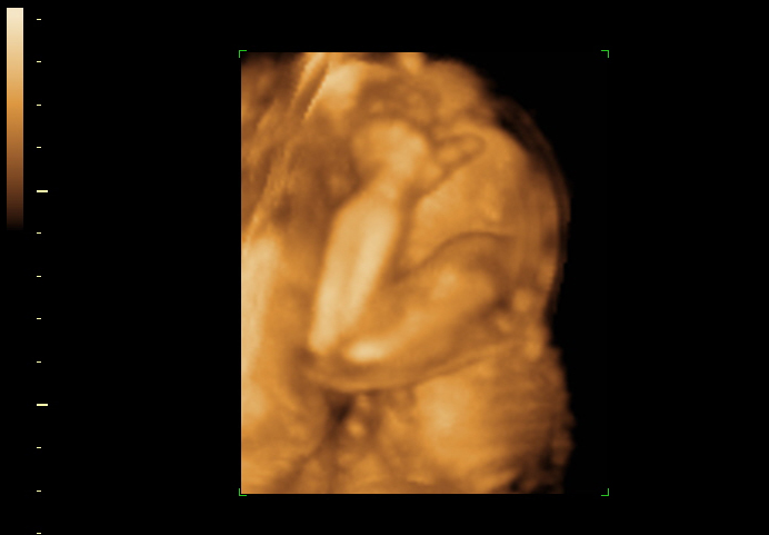 3d sonogram image at 21 weeks