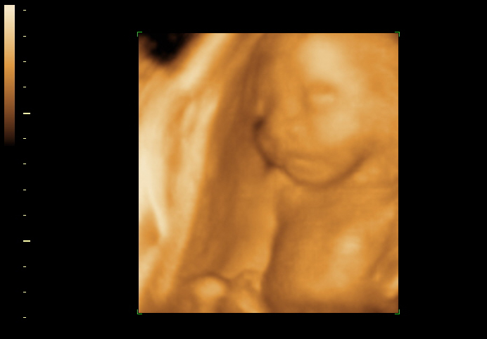 3d sonogram image at 23 weeks