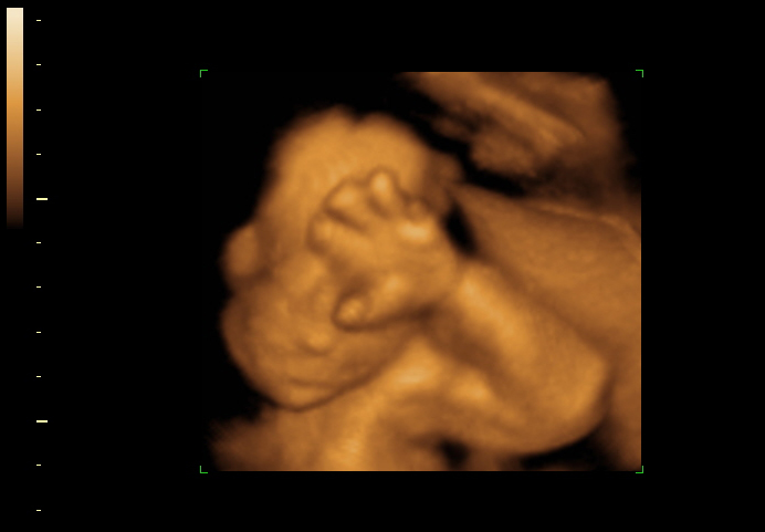 3d sonogram image at 23 weeks