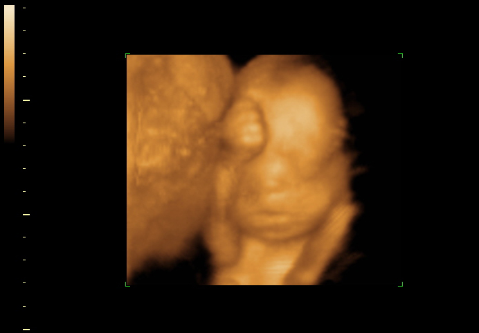 3d sonogram image at 23 weeks