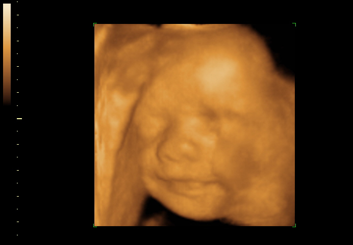 3d sonogram image at 24 weeks