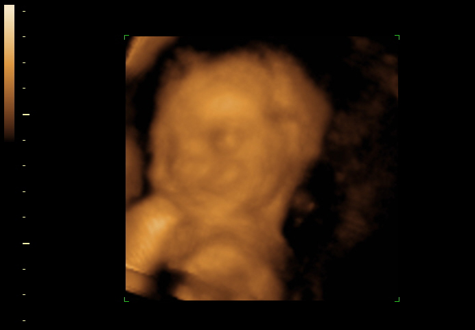 3d sonogram image at 24 weeks