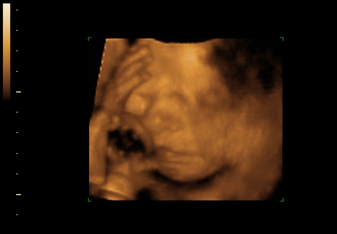 3d sonogram image at 26 weeks