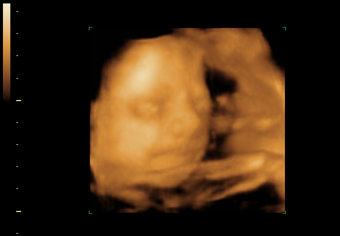 3d sonogram image at 26 weeks