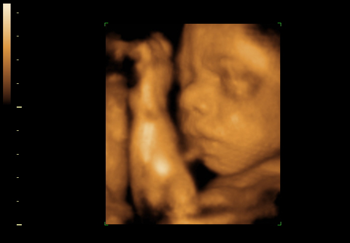 3d sonogram image at 27 weeks