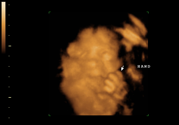 3d sonogram image at 28 weeks