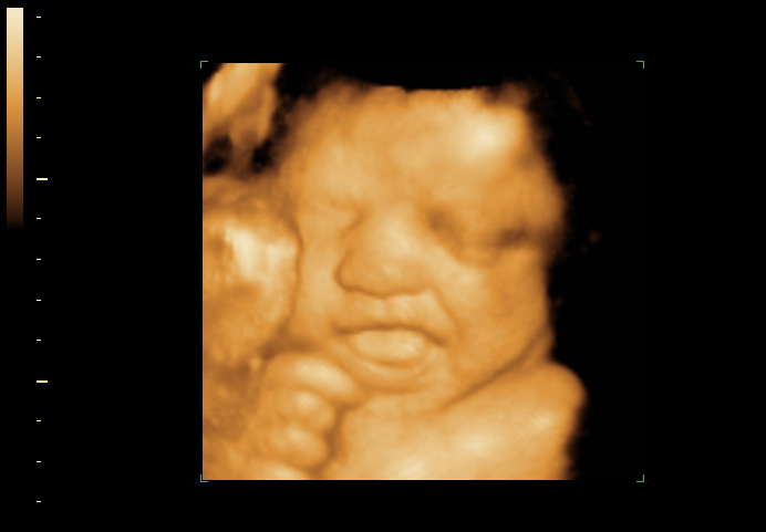 3d sonogram image at 28 weeks