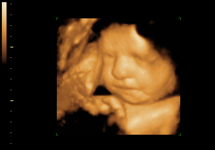 3d sonogram image at 28 weeks