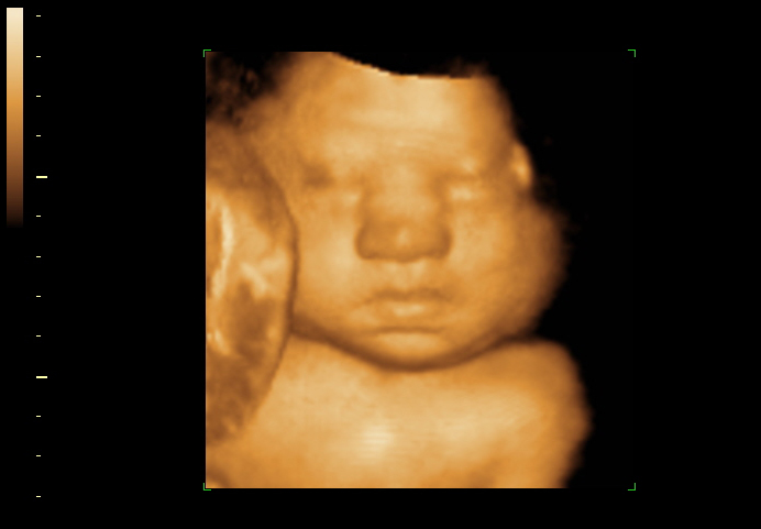 3d sonogram image at 28 weeks