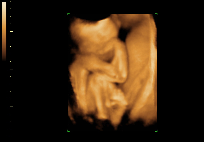 3d sonogram image at 28 weeks