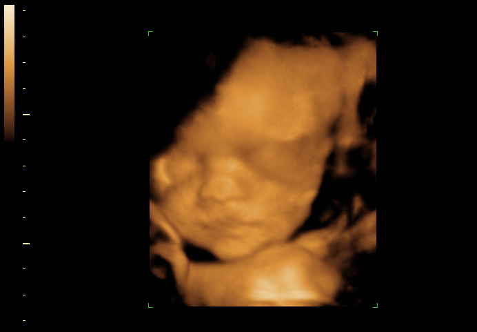 3d sonogram image at 28 weeks