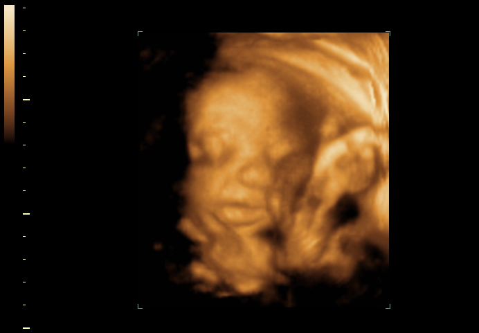 3d sonogram image at 28 weeks