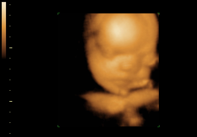 3d sonogram image at 28 weeks