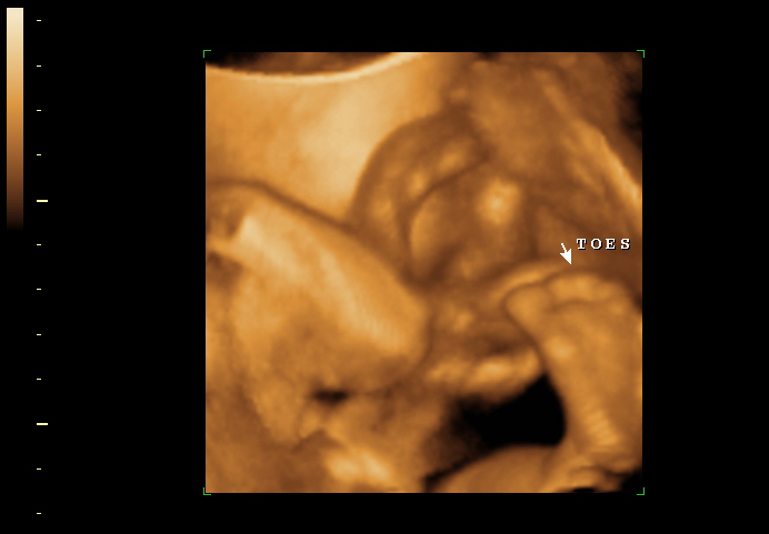 3d sonogram image at 28 weeks