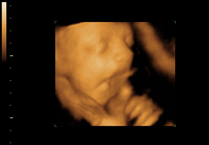 3d sonogram image at 28 weeks