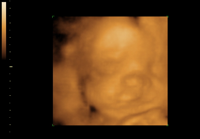 3d sonogram image at 28 weeks