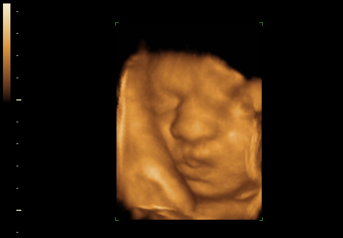 3d sonogram image at 28 weeks