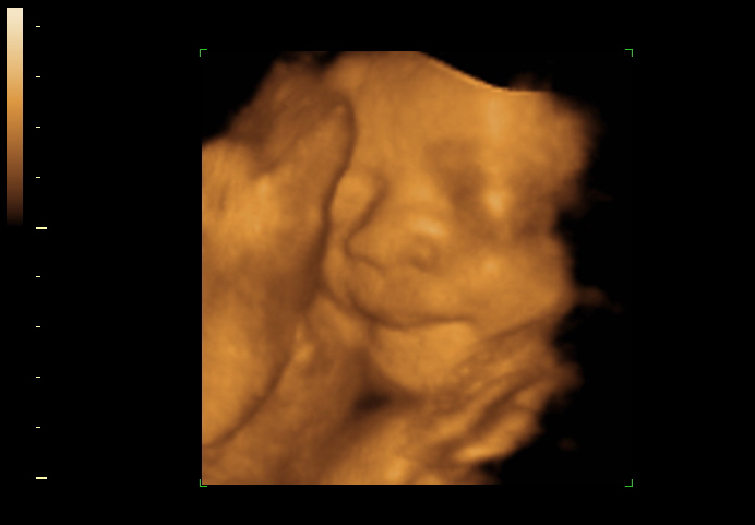 3d sonogram image at 29 weeks
