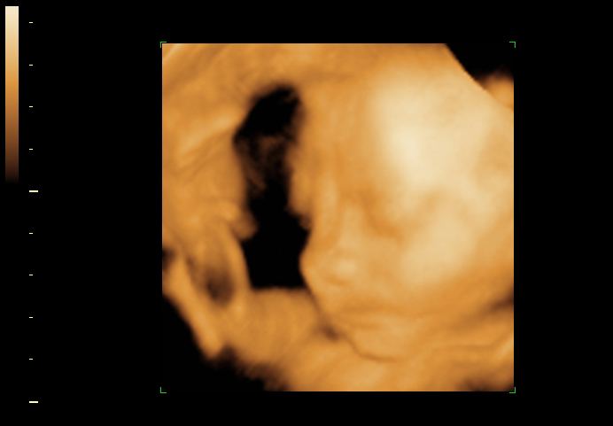 3d sonogram image at 29 weeks