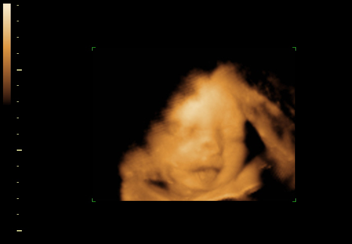 3d sonogram image at 29 weeks