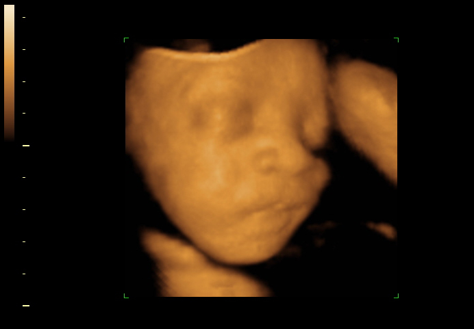 3d sonogram image at 29 weeks