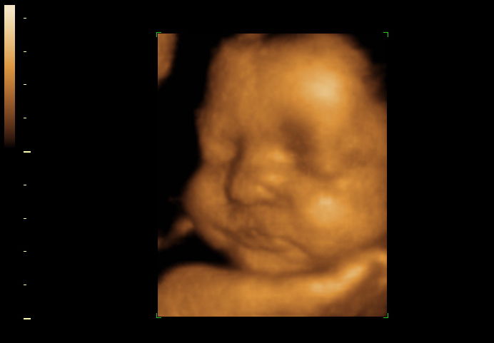 3d sonogram image at 30 weeks