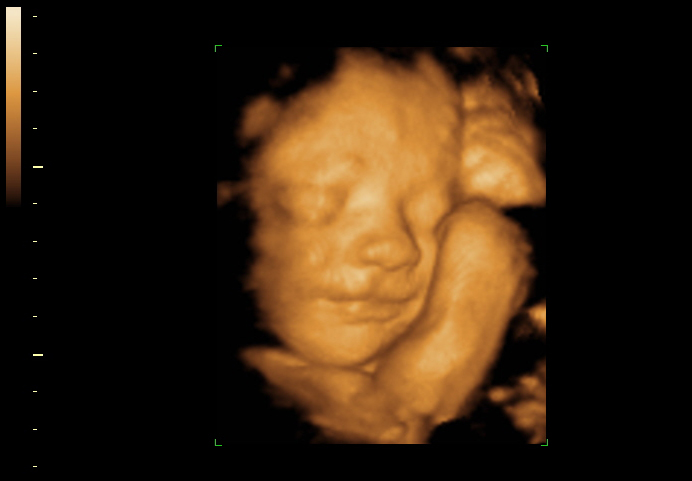 3d sonogram image at 30 weeks