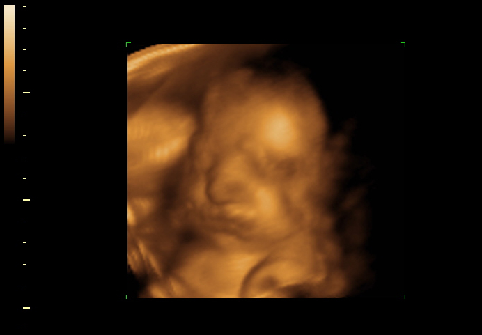 3d sonogram image at 30 weeks