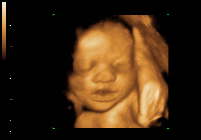 3d sonogram image at 31 weeks