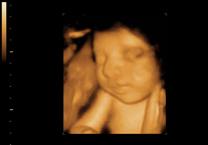 3d sonogram image at 31 weeks