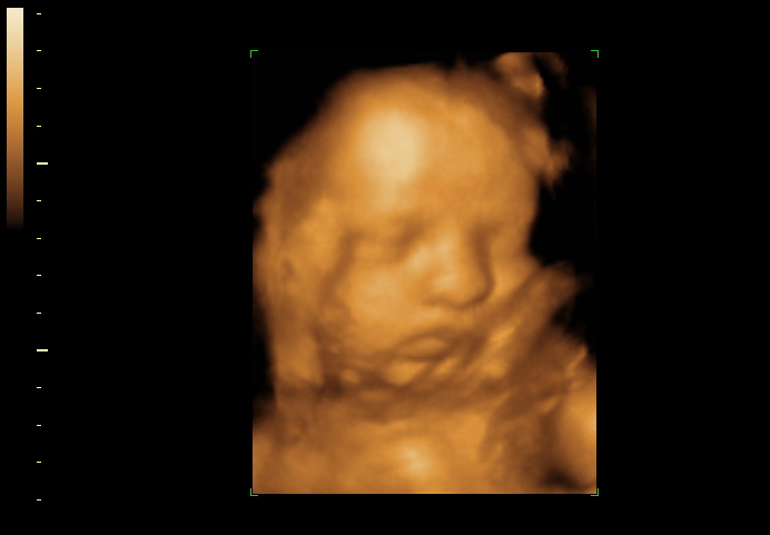 3d sonogram image at 31 weeks