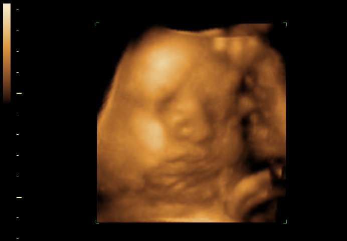 3d sonogram image at 31 weeks