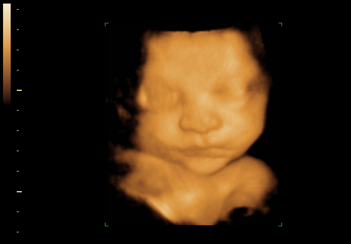 3d sonogram image at 32 weeks