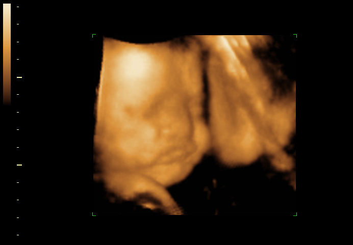 3d sonogram image at 32 weeks