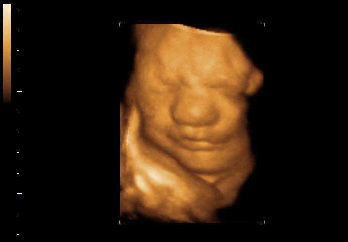 3d sonogram image at 32 weeks