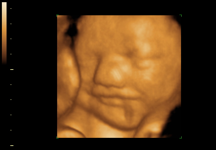 3d sonogram image at 32 weeks